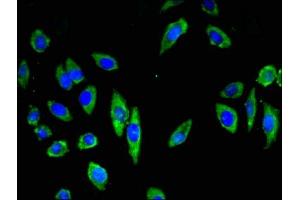 Immunofluorescent analysis of A549 cells using ABIN7146220 at dilution of 1:100 and Alexa Fluor 488-congugated AffiniPure Goat Anti-Rabbit IgG(H+L)