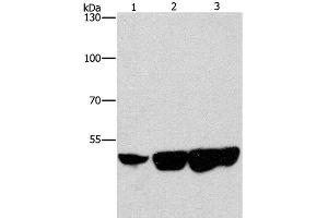Western Blot analysis of Hela, hepG2 and 231 cell using CTBP2 Polyclonal Antibody at dilution of 1:400 (CTBP2 anticorps)