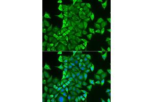 Immunofluorescence analysis of HeLa cell using CARS antibody. (CARS anticorps)