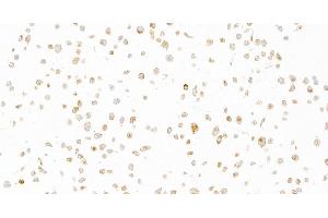 Immunocytochemistry (ICC) image for anti-Interleukin 6 Signal Transducer (Gp130, Oncostatin M Receptor) (IL6ST) (AA 23-323) antibody (ABIN7449356)