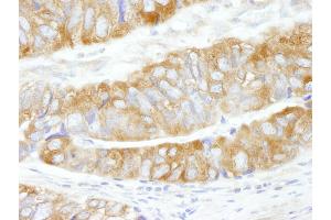 Immunohistochemistry (IHC) image for anti-Carbamoyl-Phosphate Synthetase 2, Aspartate Transcarbamylase, and Dihydroorotase (CAD) (AA 150-200) antibody (ABIN7453669)