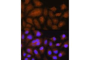 Immunofluorescence analysis of HeLa cells using GSTT2B Rabbit pAb (ABIN7267450) at dilution of 1:100. (GSTT2B anticorps  (AA 115-244))