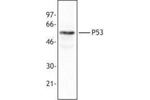 Western Blotting (WB) image for anti-Tumor Protein P53 (TP53) antibody (ABIN2664004) (p53 anticorps)