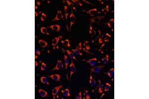 Immunofluorescence analysis of L929 cells using INPP5E antibody (ABIN7267883) at dilution of 1:100.