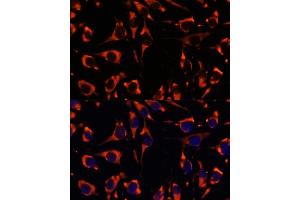 Immunofluorescence analysis of L929 cells using INPP5E antibody (ABIN7267883) at dilution of 1:100. (INPP5E anticorps  (AA 510-630))