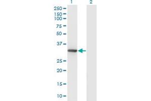 Western Blot analysis of DNALI1 expression in transfected 293T cell line by DNALI1 monoclonal antibody (M04A), clone 2H3.