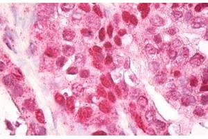 Anti-CNOT4 / CLONE243 antibody IHC staining of human prostate. (CNOT4 anticorps  (AA 50-100))