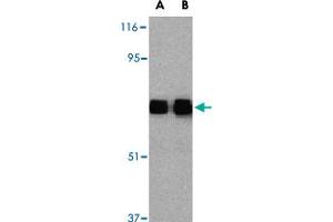 Western blot analysis of TLR10 in human lymph node tissue lysates with TLR10 polyclonal antibody  at (A) 0. (TLR10 anticorps  (Internal Region))