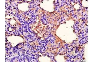 Rat lung lysates probed with ANKK1 Polyclonal Antibody, unconjugated  at 1:400 overnight at 4°C followed by a conjugated secondary antibody for 20 minutes at 37°C.