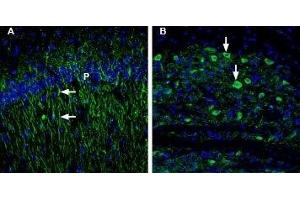 Expression of 5-Hydroxytryptamine receptor 1B in rat and mouse brain - Immunohistochemical staining of rat and mouse brain sections using Anti-5HT1B Receptor (HTR1B) (extracellular) Antibody (ABIN7043616, ABIN7045280 and ABIN7045281), (1:200).