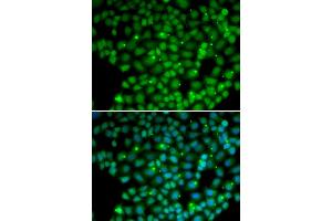 Immunofluorescence analysis of U2OS cells using MUTYH antibody (ABIN5970784). (MUTYH anticorps)