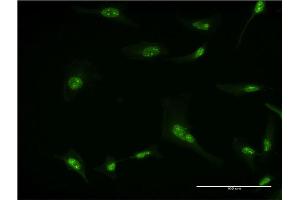 Immunofluorescence of monoclonal antibody to RPL7 on HeLa cell. (RPL7 anticorps  (AA 158-248))