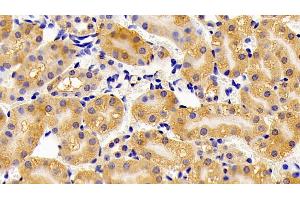 Detection of HADH in Mouse Kidney Tissue using Polyclonal Antibody to Hydroxyacyl Coenzyme A Dehydrogenase (HADH)