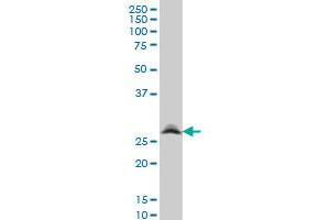 RNF141 monoclonal antibody (M01), clone 6D9 Western Blot analysis of RNF141 expression in A-431 .