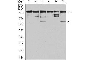 Western blot analysis using ZFP91 mouse mAb against Jurkat (1), A431 (2), HepG2 (3), HEK293 (4), A549 (5), and PC-3 (6) cell lysate.