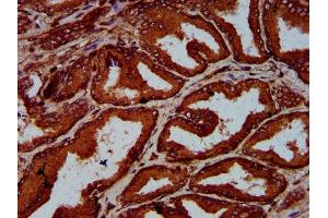 IHC image of ABIN7151584 diluted at 1:600 and staining in paraffin-embedded human prostate tissue performed on a Leica BondTM system. (ELP4 anticorps  (AA 117-223))