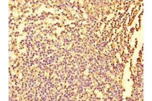 anti-Fidgetin (FIGN) (AA 132-371) antibody