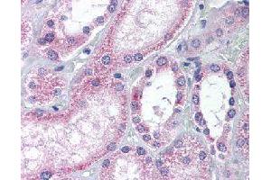 Immunohistochemical (Formalin/PFA-fixed paraffin-embedded sections) staining in human kidney with AADAT polyclonal antibody . (AADAT anticorps)