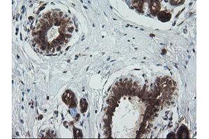 Image no. 11 for anti-Tripartite Motif Containing 44 (TRIM44) antibody (ABIN1501505) (TRIM44 anticorps)