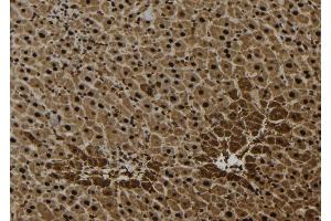 ABIN6277063 at 1/100 staining Mouse liver tissue by IHC-P. (FGFR1 anticorps  (C-Term))