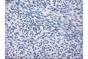 Image no. 8 for anti-Fc gamma RII (CD32) antibody (ABIN1497255) (Fc gamma RII (CD32) anticorps)