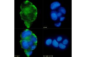 anti-Lewis Blood Group A/b antibody