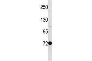 Pak7 antibody western blot analysis in mouse stomach tissue lysate