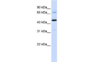 WB Suggested Anti-SFXN4 Antibody Titration: 0. (Sideroflexin 4 anticorps  (C-Term))