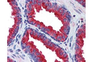 Immunohistochemistry (IHC) image for anti-Klotho (KL) (Middle Region) antibody (ABIN2776875)