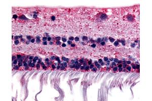Anti-RGR antibody IHC of human retina. (RGR anticorps  (Extracellular Domain))