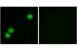 Immunofluorescence analysis of MCF7 cells, using IPKB Antibody. (PKIB anticorps  (AA 29-78))