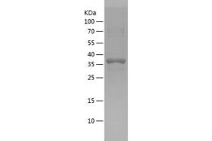 Western Blotting (WB) image for Growth Differentiation Factor 1 (GDF1) (AA 254-372) protein (His-IF2DI Tag) (ABIN7123205)