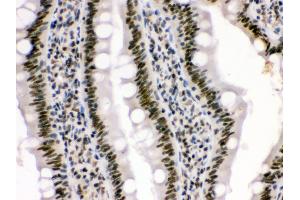 Anti- HMG4 Picoband antibody, IHC(P) IHC(P): Rat Intestine Tissue