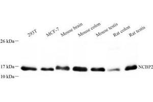 Western blot analysis of NCBP2 (ABIN7074870) at dilution of 1: 300 (NCBP2 anticorps)