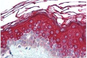 Human Skin (formalin-fixed, paraffin-embedded) stained with ALAS1 antibody ABIN290712 at 5 ug/ml followed by biotinylated goat anti-rabbit IgG secondary antibody ABIN481713, alkaline phosphatase-streptavidin and chromogen. (ALAS1 anticorps  (AA 480-530))
