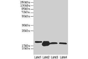 Western blot All lanes: DHRS3 antibody at 0. (DHRS3 anticorps  (AA 30-169))
