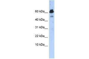 WB Suggested Anti-ABAT Antibody Titration: 0. (ABAT anticorps  (Middle Region))