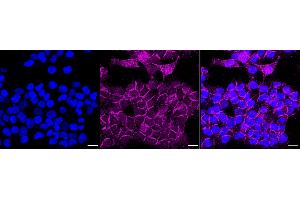 Immunocytochemical staining of Hela cells with HNRNPA1 antibody(ABIN7798894), 1:1,000).