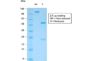 SDS-PAGE Analysis Purified CD44v4 Mouse Recombinant Monoclonal Antibody (rCD44v4/1219).