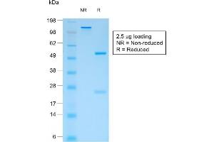 SDS-PAGE Analysis Purified CD44v4 Mouse Recombinant Monoclonal Antibody (rCD44v4/1219). (Recombinant CD44 anticorps)