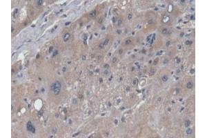 Detection of NAGLU in Human Liver Tissue using Polyclonal Antibody to N-Acetyl Alpha-D-Glucosaminidase (NAGLU)