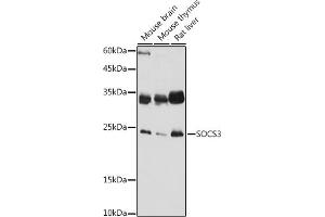 Western blot analysis of extracts of various cell lines, using SOCS3 antibody (ABIN3015316, ABIN3015317, ABIN5663764 and ABIN6213984) at 1:1000 dilution. (SOCS3 anticorps  (C-Term))
