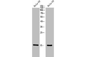 Western Blot analysis of Hela+UV 5' cells using Phospho-Histone H2A (T121) Polyclonal Antibody. (HIST1H2AG/HIST1H2AB/HIST1H2AD/HIST1H2AH/HIST2H2AA3/HIST3H2A (pThr121) anticorps)