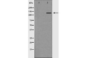 Western blot analysis of Collagen III expression in HT1080 Whole cell lysate. (COL3A1 anticorps  (N-Term))