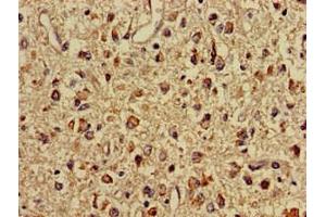 Immunohistochemistry of paraffin-embedded human glioma using ABIN7159696 at dilution of 1:100 (IMMT anticorps  (AA 76-215))