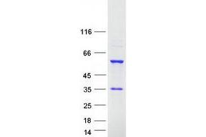 Validation with Western Blot