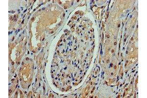 Immunohistochemistry of paraffin-embedded human kidney tissue using ABIN7169424 at dilution of 1:100 (ASH2L anticorps  (AA 1-534))