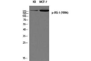 Western Blot (WB) analysis of KB MCF-7 using p-IRS-1 (Y896) antibody. (IRS1 anticorps  (pTyr896))