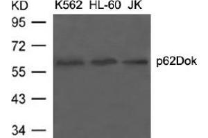 Image no. 3 for anti-Docking Protein 1, 62kDa (Downstream of tyrosine Kinase 1) (DOK1) (Tyr398) antibody (ABIN197538) (DOK1 anticorps  (Tyr398))