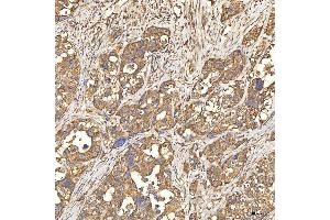 IHC analysis of Citrin/SLC25A13 using anti-Citrin/SLC25A13 antibody (ABIN7599512). (slc25a13 anticorps  (AA 1-643))